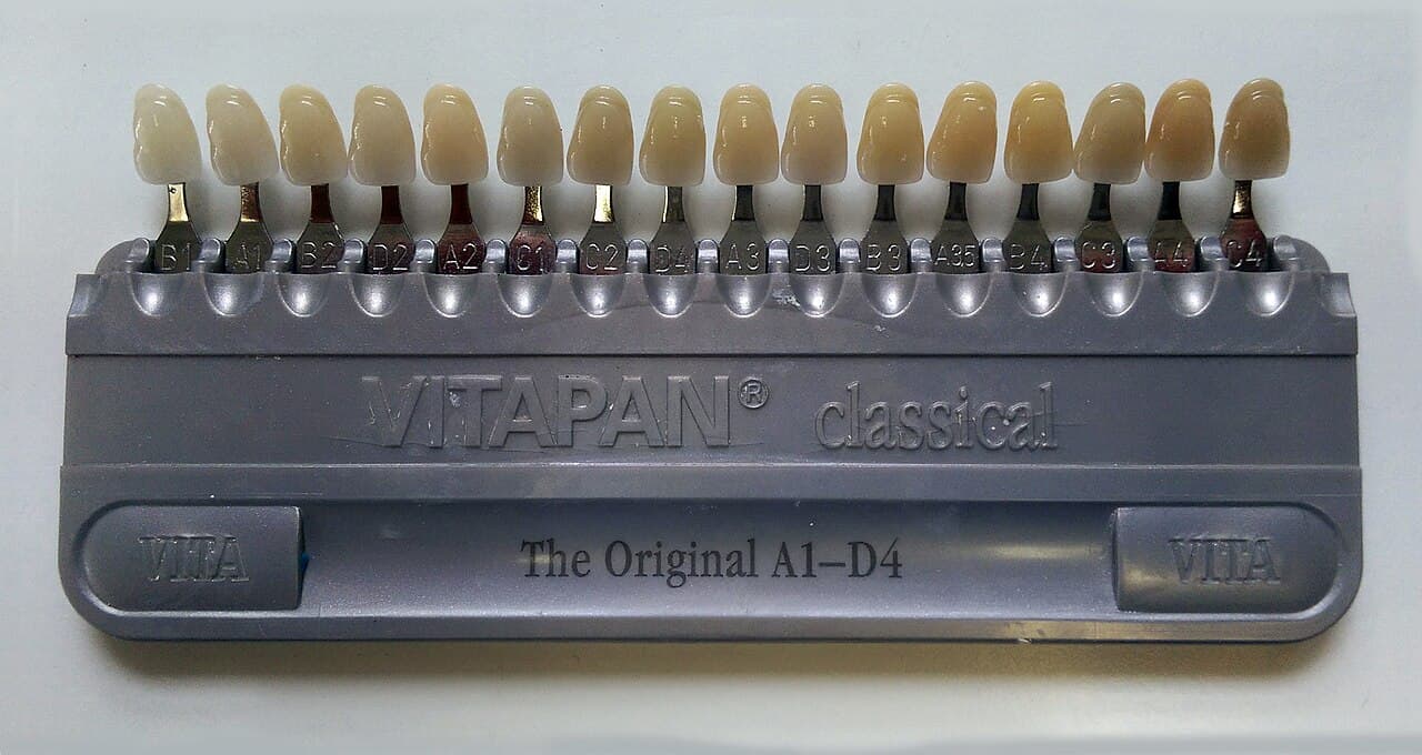 VITA dental shade guide showing tooth color tabs from light to dark
